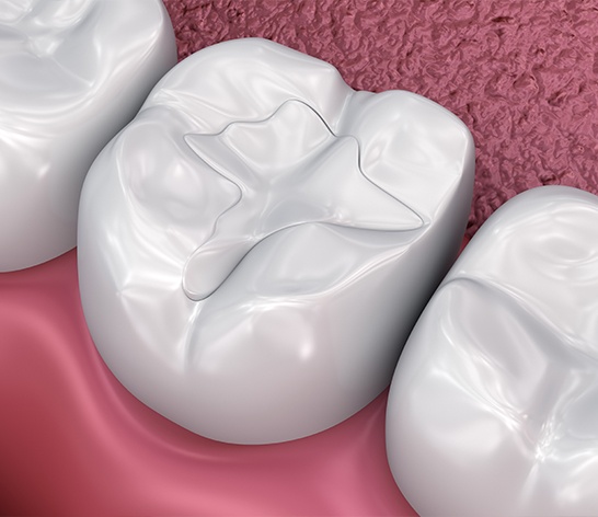 Closeup of smile with tooth colored dental restorations