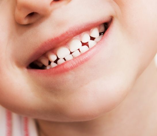 Child's smile after dental crown restoration