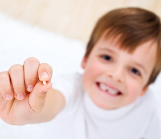 Smiling child with missing tooth after extraction